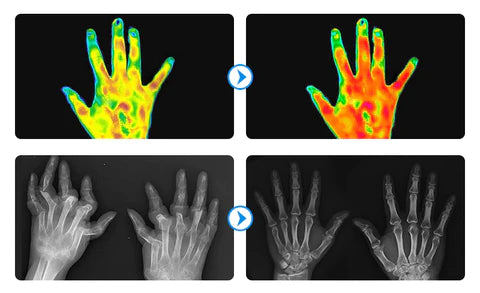 Gelenk- und Knochentherapie-Handschuhe
