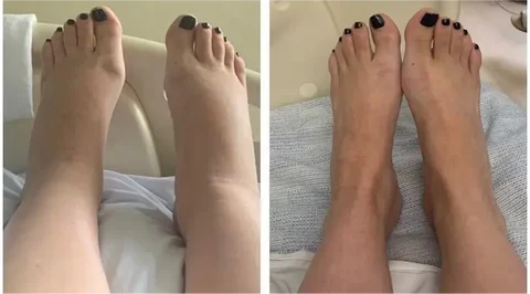Akupunktur Stimulator-Massage Fußmatte