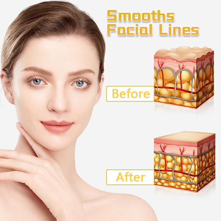 Skin Ultraschall-Faceliftgerät