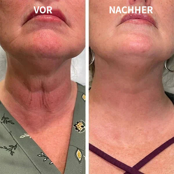Aseja Geischtsserum