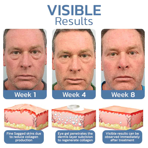 Aseja™ Awaken Peptide Lifting Augengel