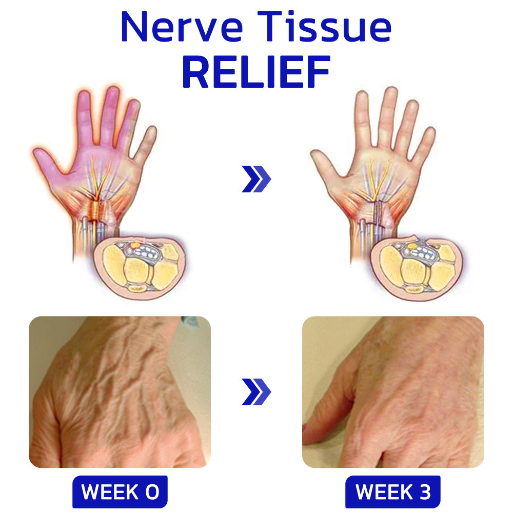 Hand-und Fußspray bei Gelenkbeschwerden