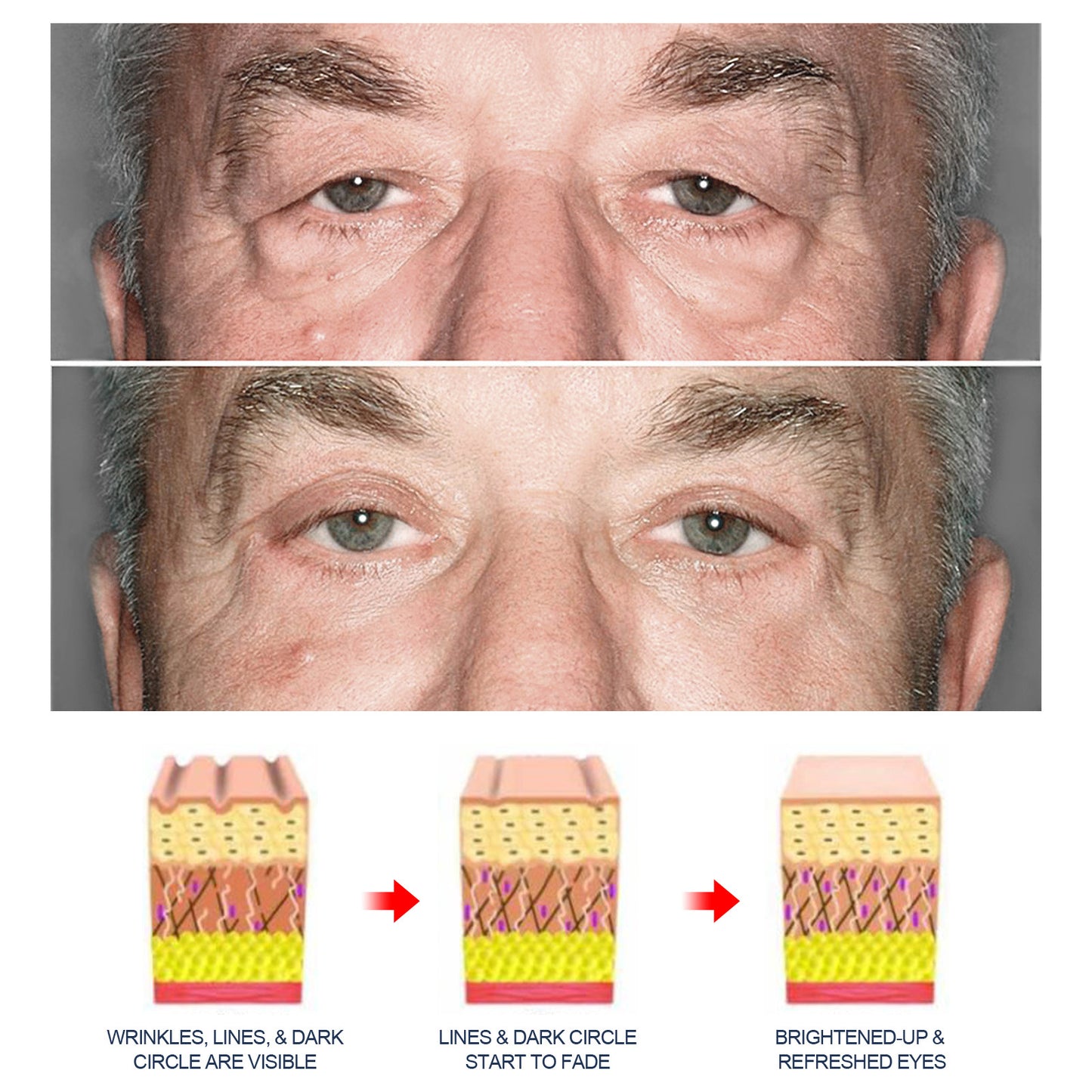Aseja™ Awaken Peptide Lifting Augengel