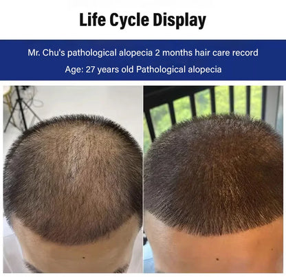 Haarwachstums Shampoo