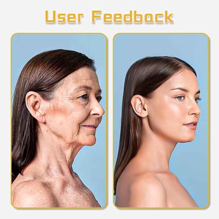 Skin Ultraschall-Faceliftgerät