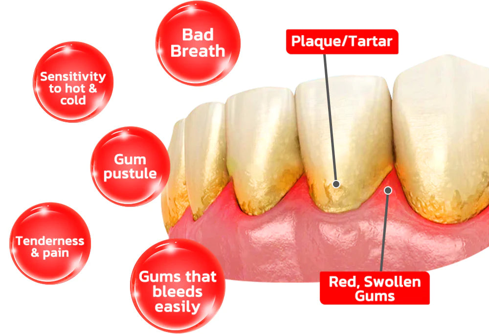 Zahnaufhellung mit Einem Kaugummi